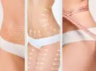 post bariatrik cerrahi ile hayata yeniden 1