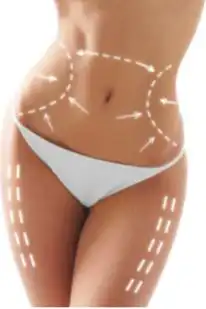 post bariatrik cerrahi ile hayata yeniden 5