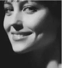 yuz genclestirme ameliyatlari dogru kiside dogru zamanda dogal sonuclar 1